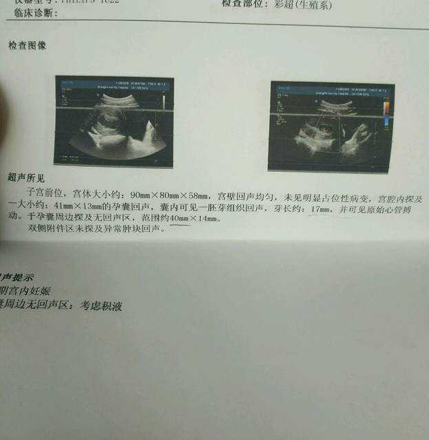 贵州高龄供卵风险，贵州做试管婴儿需多少钱