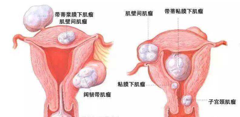 香港最可靠代怀孕，2022年香港特别行政区供卵试管助孕医院排名，内附试管成